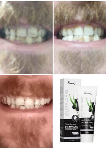 homm bitkisel dis macunu - Görsel 5