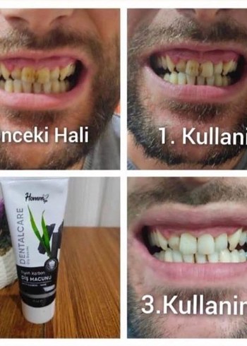 homm bitkisel dis macunu - Görsel 4