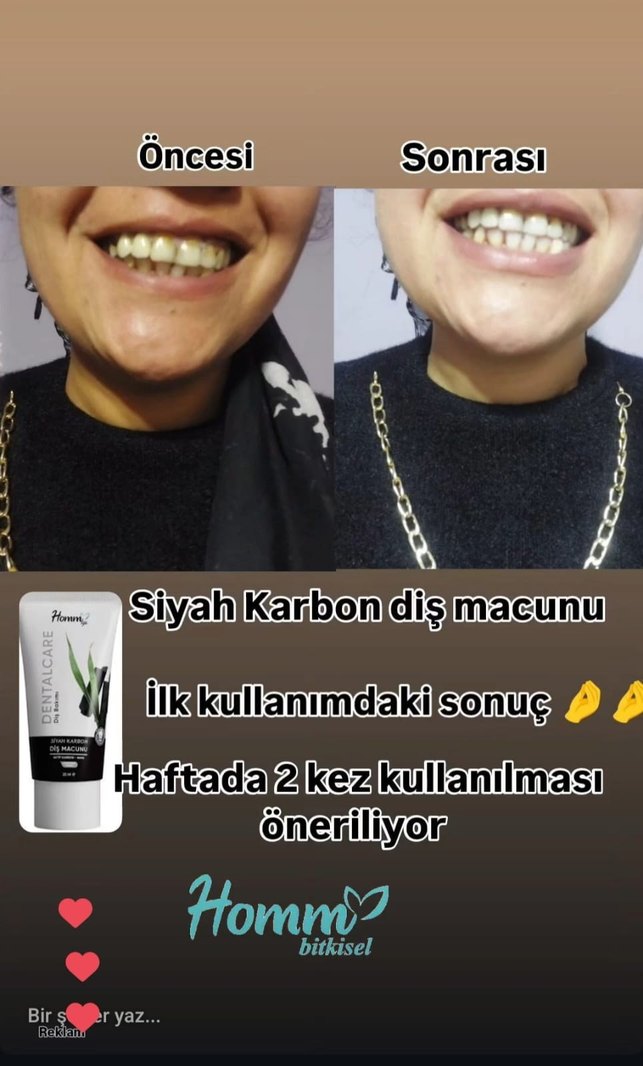 homm bitkisel dis macunu - Görsel 3