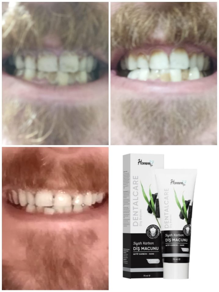 homm bitkisel dis macunu - Görsel 5