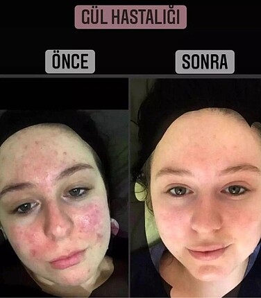 Beden Şeffaf sabun