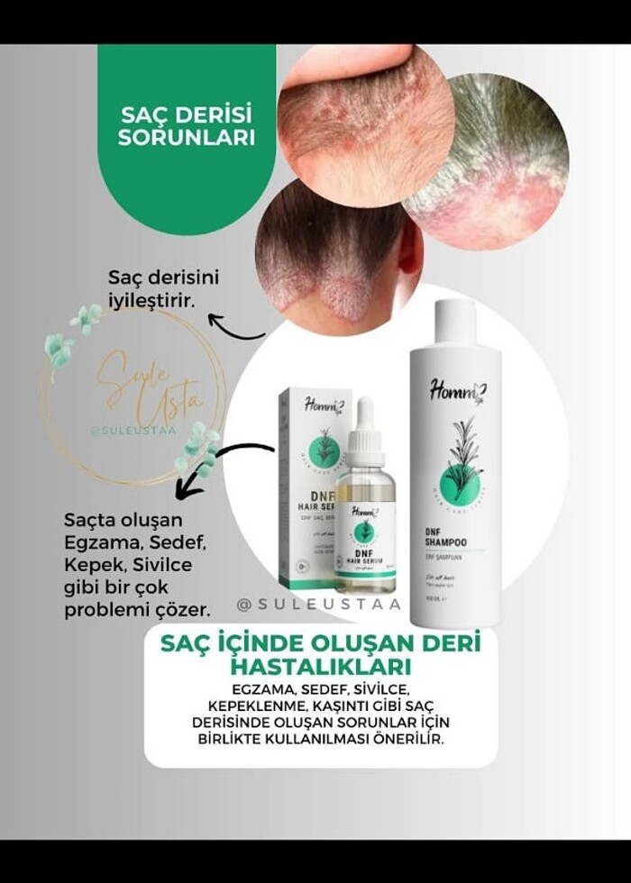 Kepek karsiti serum - Görsel 3