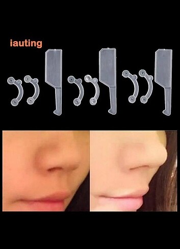 ŞEFFAF BURUN KALDİRMA APARATİ - Görsel 5