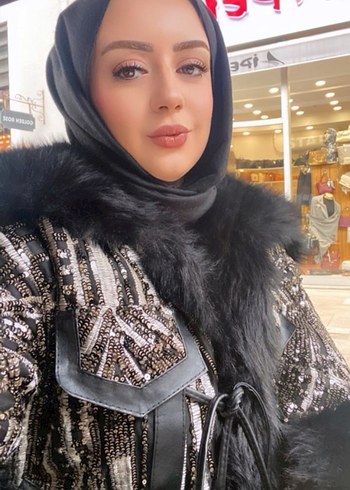 Siyah Parlak Kürklü Uzun Kadın Mont - Görsel 2