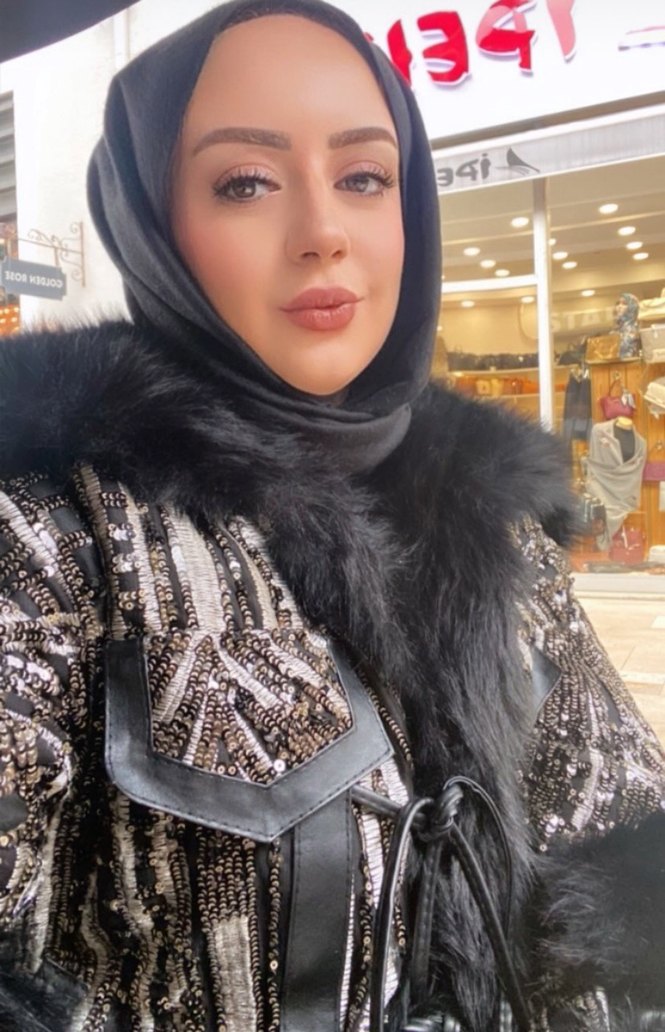 Siyah Parlak Kürklü Uzun Kadın Mont - Görsel 2