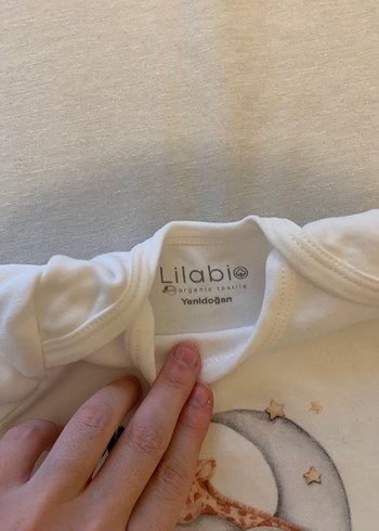 Erkek Bebek Aras isimli Hastane Çıkışı - Görsel 6