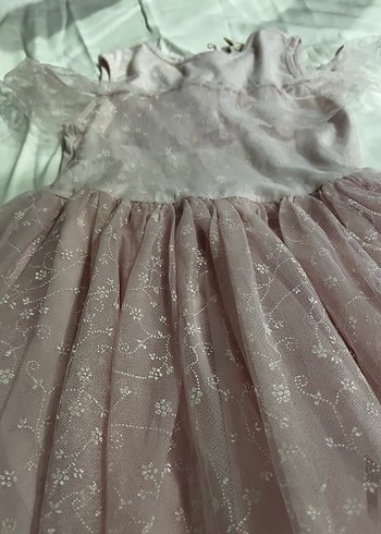 Pembe Dantel Detaylı Kız Çocuk Elbise - Görsel 2