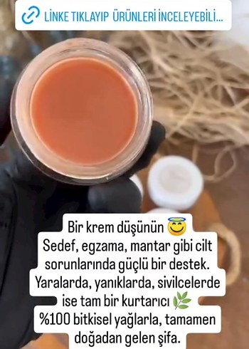 egzama, sivilce, mantar ,kaşıntı ve yara kremi - Görsel 2