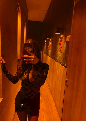 dantel detaylı mini elbise - Görsel 2