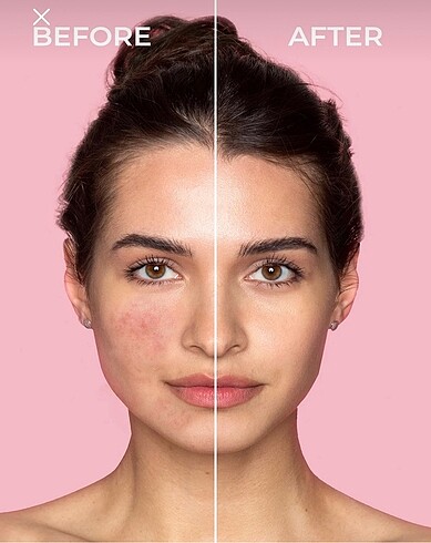 Sinoz fondotenli cica onarıcı krem - Görsel 5