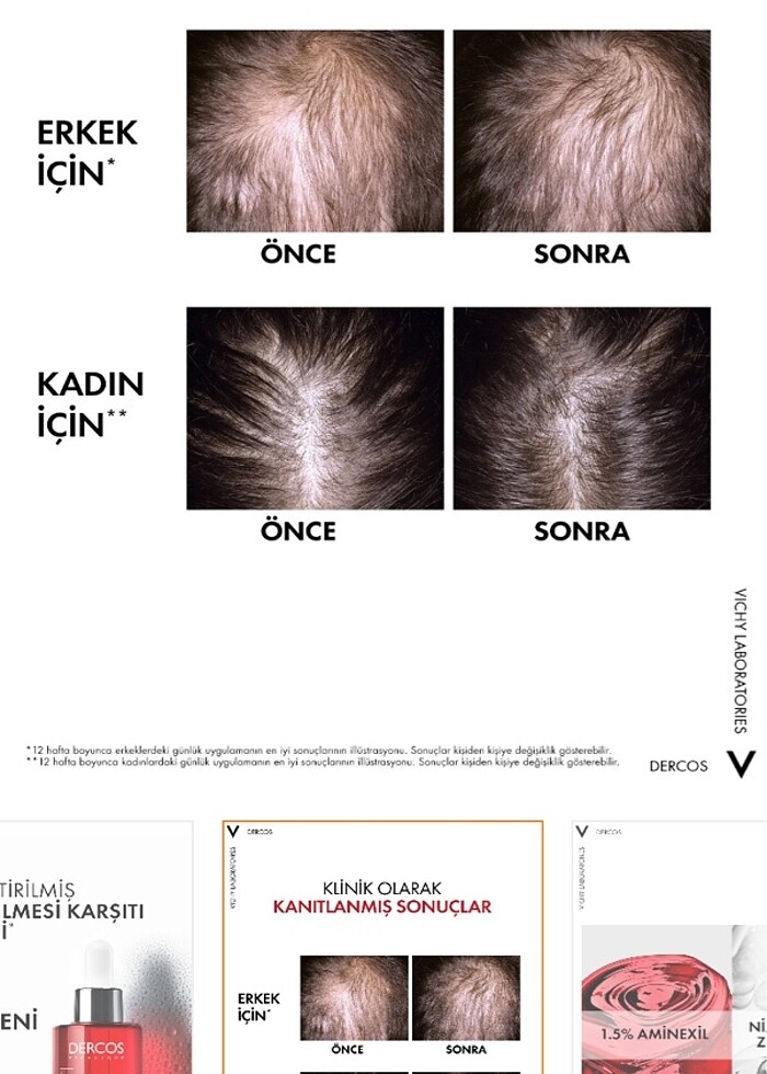Vichy Saç Dökülmesine Karşı Saç Bakım Serumu - Görsel 3