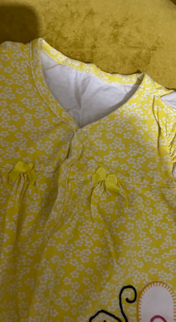 Sarı Desenli çıt çıtlı Bebek Kız Tulum - Görsel 4