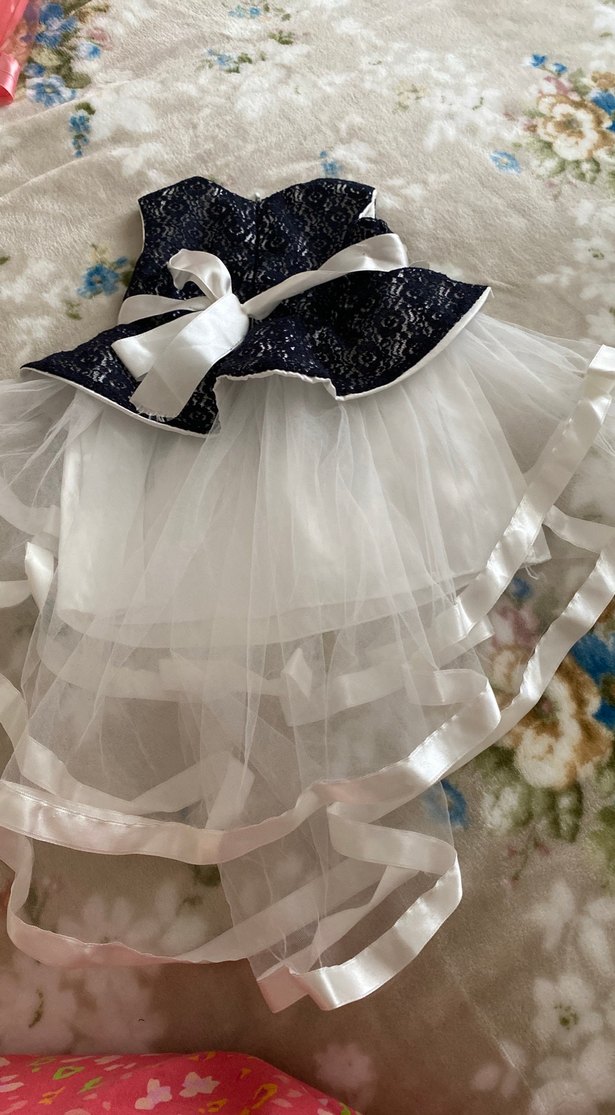 Kız Çocuk Siyah Beyaz Dantel Elbise - Görsel 3