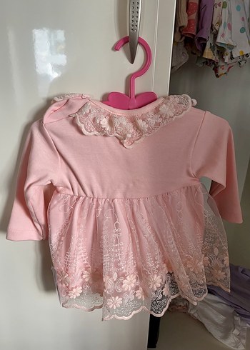 Dantel Detaylı Pembe Kız Çocuk Elbisesi - Görsel 2