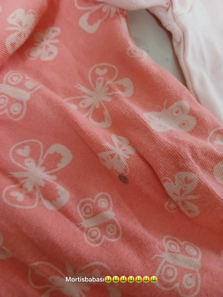 Uzun Kollu Pembe Bebek Body - Görsel 5