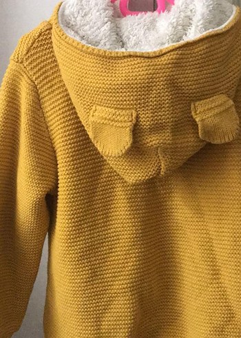 Sarı Düğmeli Kız Triko Hırka - Görsel 2