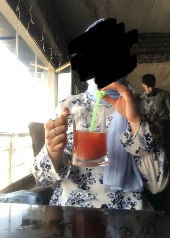 Mavi çiçek desenli tunik - Görsel 2