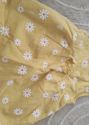 Sarı Baskılı Bebek Önlüğü 9 Ay/M - Görsel 2