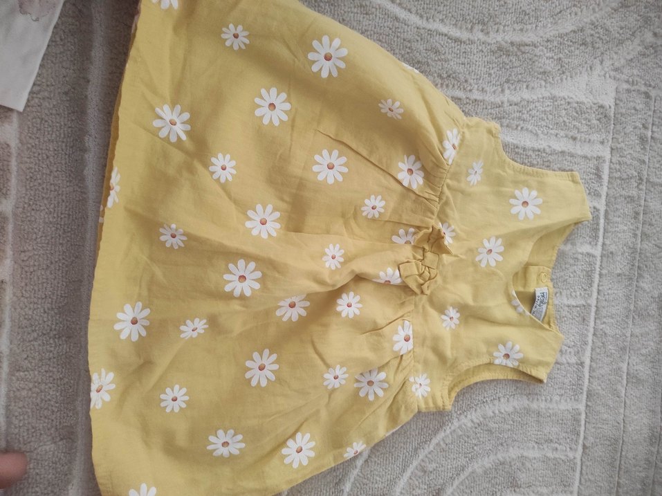 Sarı Baskılı Bebek Önlüğü 9 Ay/M - Görsel 2