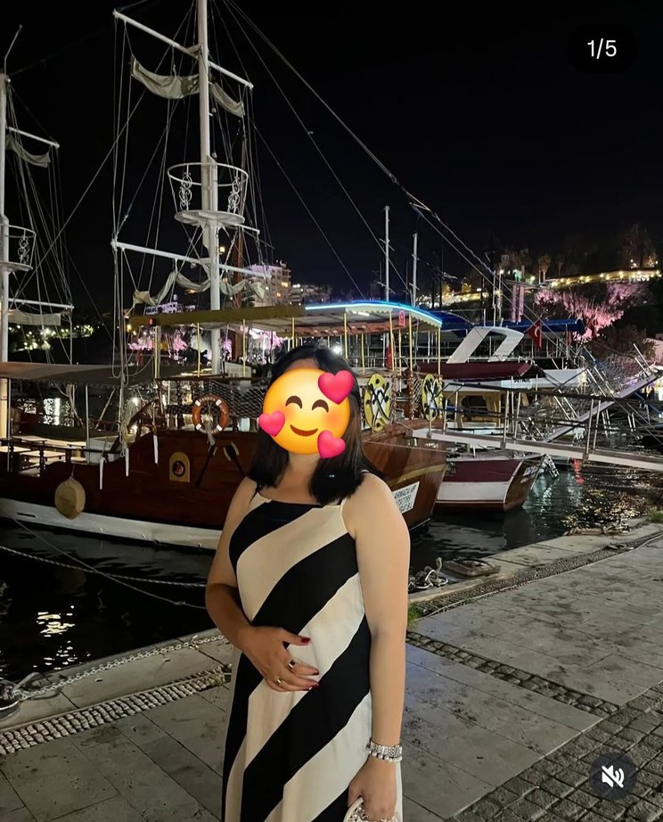 Zebra Desenli Uzun Salaş Kadın Elbise - Görsel 2