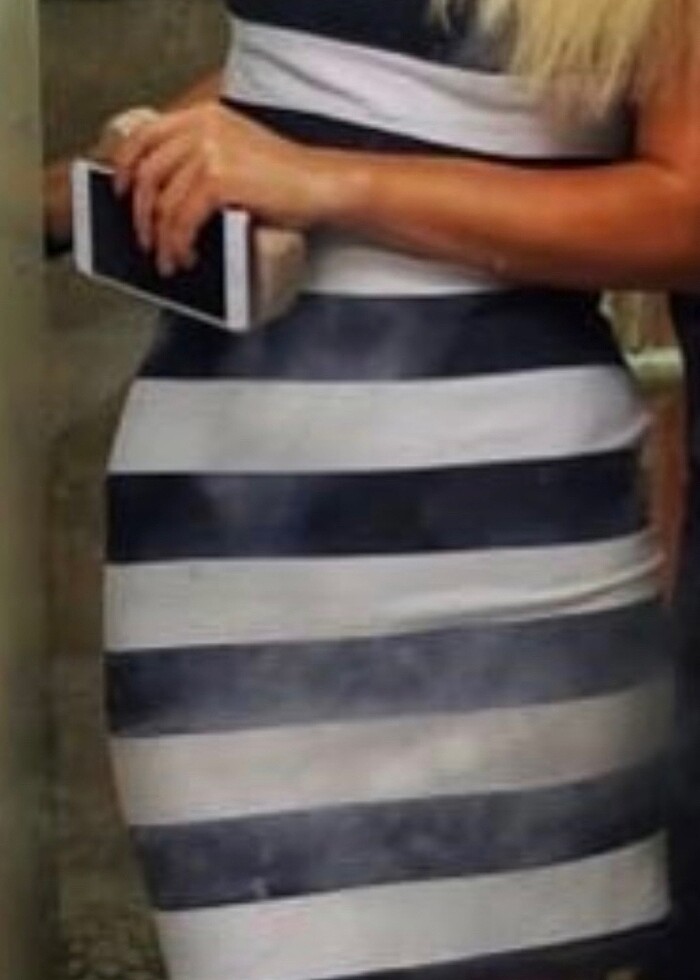 Çizgili günlük elbise - Görsel 5