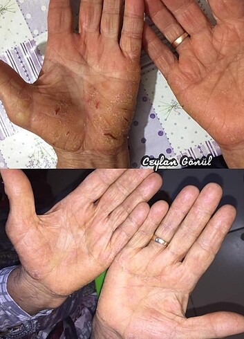 Aleovera box set - Görsel 5