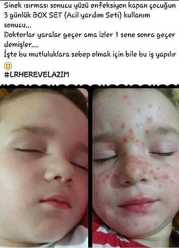 Aleovera box set - Görsel 6