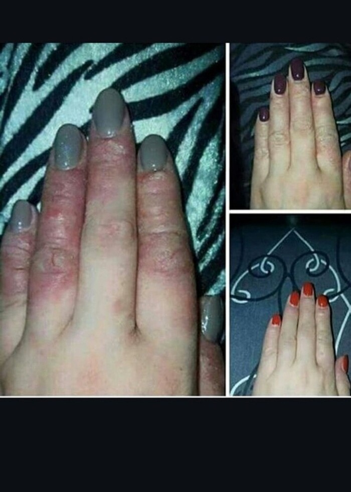 Aleovera box set - Görsel 2