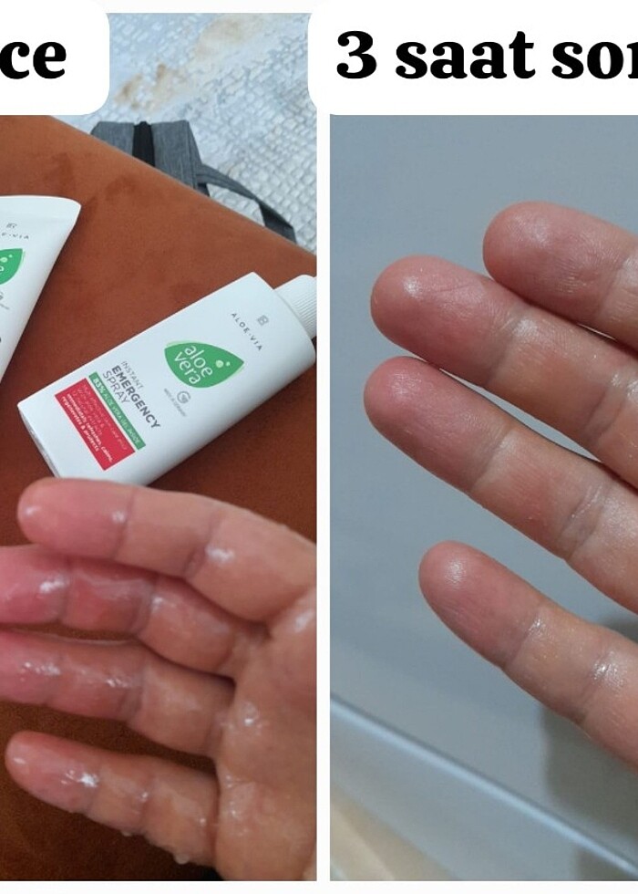 Aleovera box set - Görsel 4