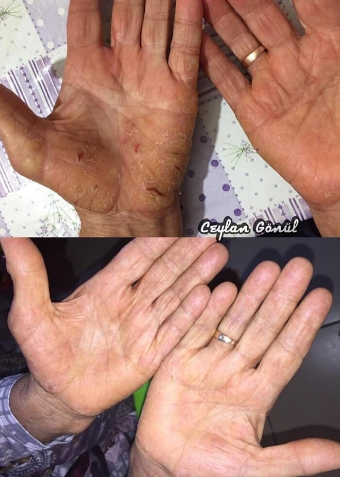 Aleovera box set - Görsel 5