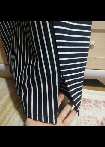 Çizgili Siyah Midi Askılı Elbise - Görsel 2