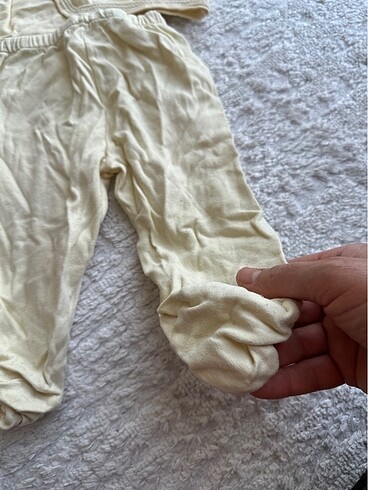 Hastane çıkışı alt üst takım - Görsel 11