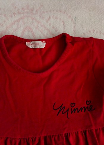 Kız Çocuk Kırmızı Baskılı Elbise - Görsel 3