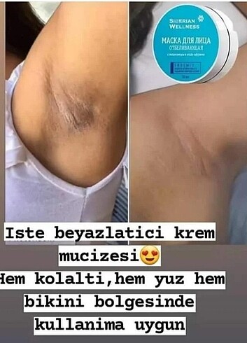 Beyazlatici krem