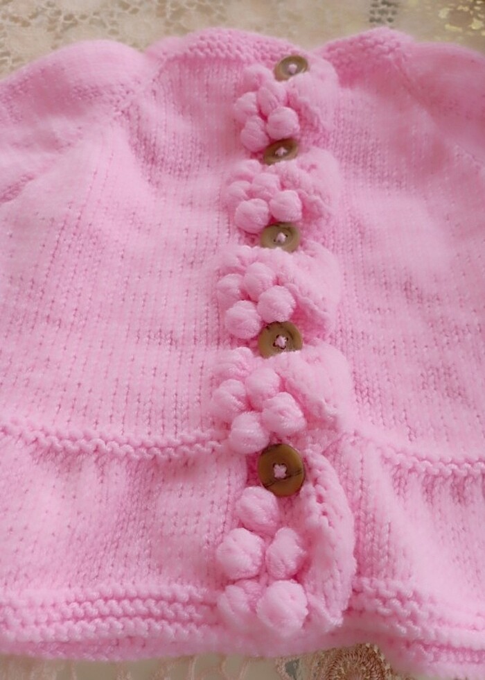 Bebek hirka - Görsel 5