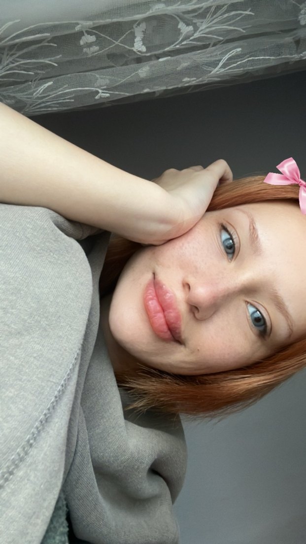 Hypnose Star Blue 1 Yıllık Renkli Lens - Görsel 3