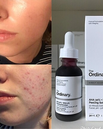 The Ordinary Aha bha maske