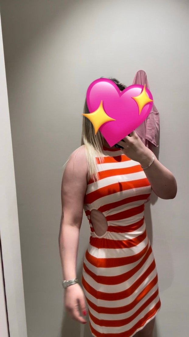 Turuncu Çizgili Pamuklu Elbise - Görsel 2