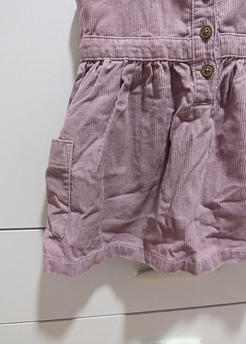 24-36 Ay Beden Kız Çocuk Düğmeli Pembe Pamuk Elbise