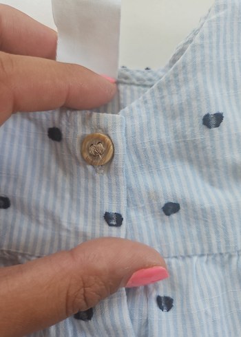 Düğmeli Kısa Kollu Bebek Kız Takımı - Görsel 5