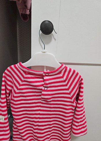 Cigit 3-6 ay Bebek Tulumu - Görsel 4