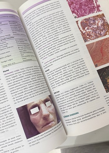 Temel Patoloji Kitabı - Görsel 4