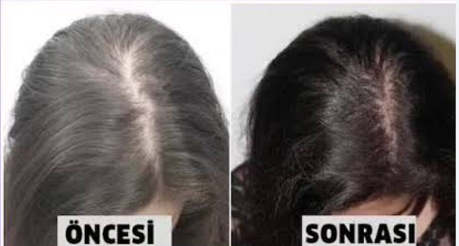 Saç dökülme karşıtı saç çıkaran şampuan - Görsel 10