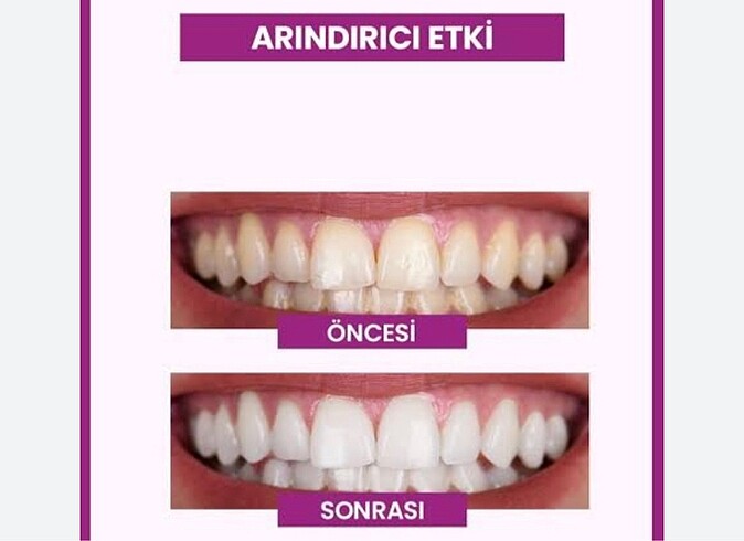 Propolis özlü beyazlatıcı diş macunu - Görsel 8