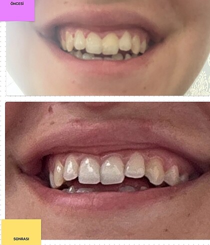 Propolis özlü beyazlatıcı diş macunu - Görsel 9