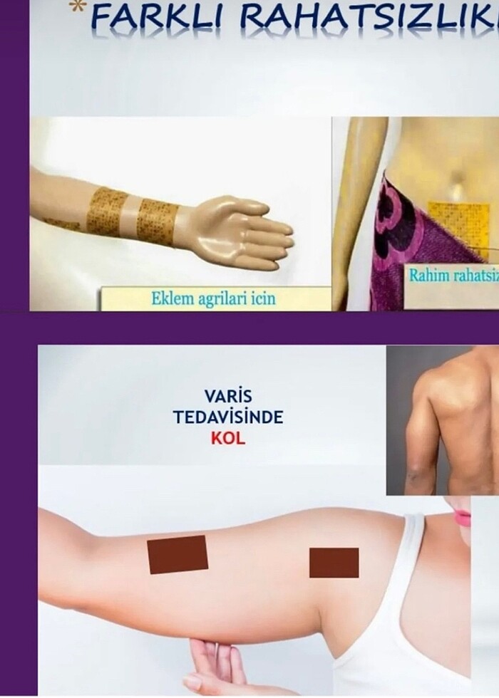 Ağrı kesici bant - Görsel 5