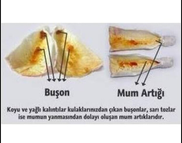 Kulak mumu iki adet