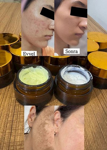 Leke kremi - Görsel 2