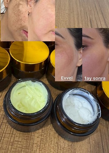 Leke kremi - Görsel 3