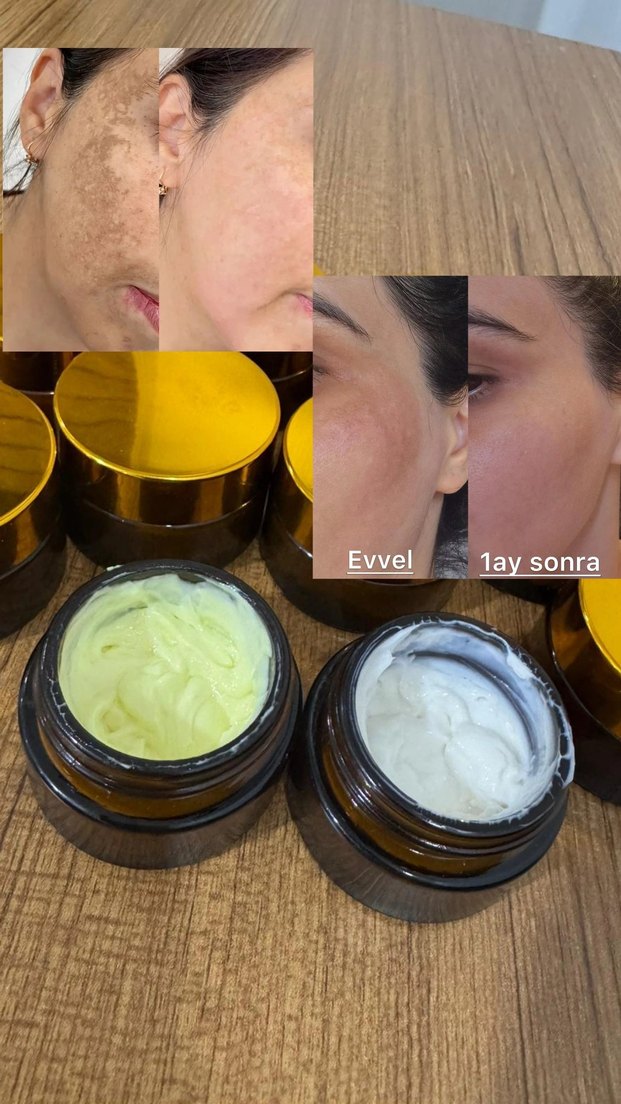 Leke kremi - Görsel 3